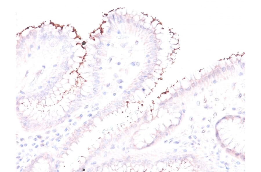 Immunohistochemistry - Anti-Helicobacter Pylori Antibody (A251026) - Antibodies.com