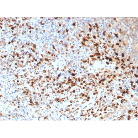 Immunohistochemistry - Anti-HSV1 Antibody (A251027) - Antibodies.com