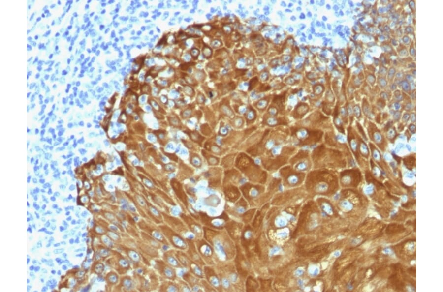 Immunohistochemistry - Anti-pan Cytokeratin Antibody (A251028) - Antibodies.com