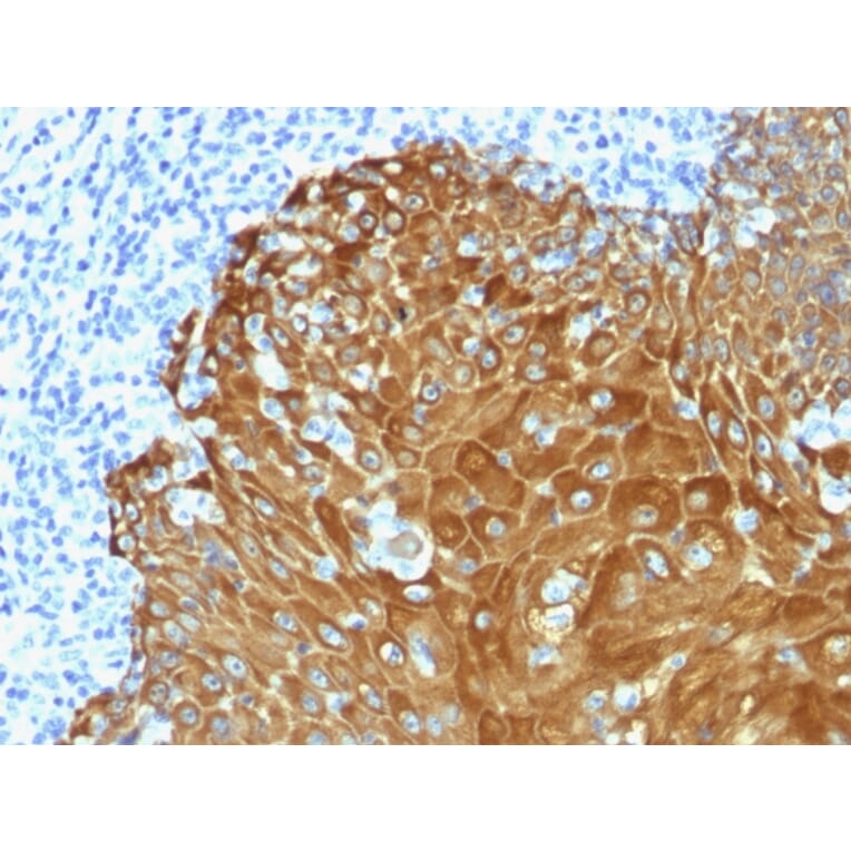 Immunohistochemistry - Anti-pan Cytokeratin Antibody (A251028) - Antibodies.com
