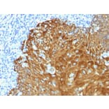 Immunohistochemistry - Anti-pan Cytokeratin Antibody (A251028) - Antibodies.com