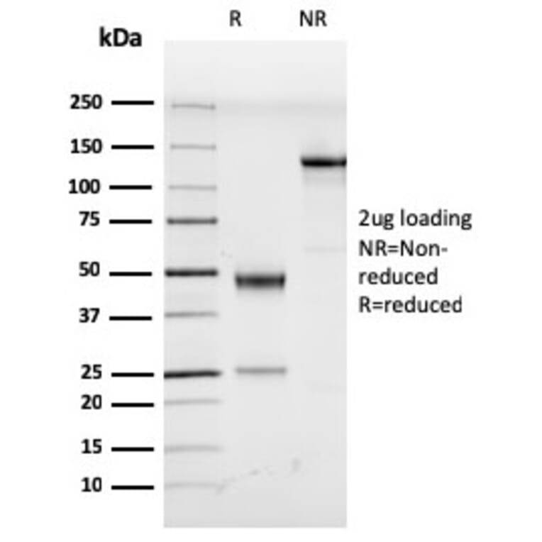 SDS-PAGE - Anti-HHV8 LNA-1 Antibody [LN53] (A251029) - Antibodies.com