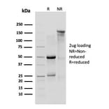 SDS-PAGE - Anti-IL10RA Antibody [1B1.3a] (A251031) - Antibodies.com