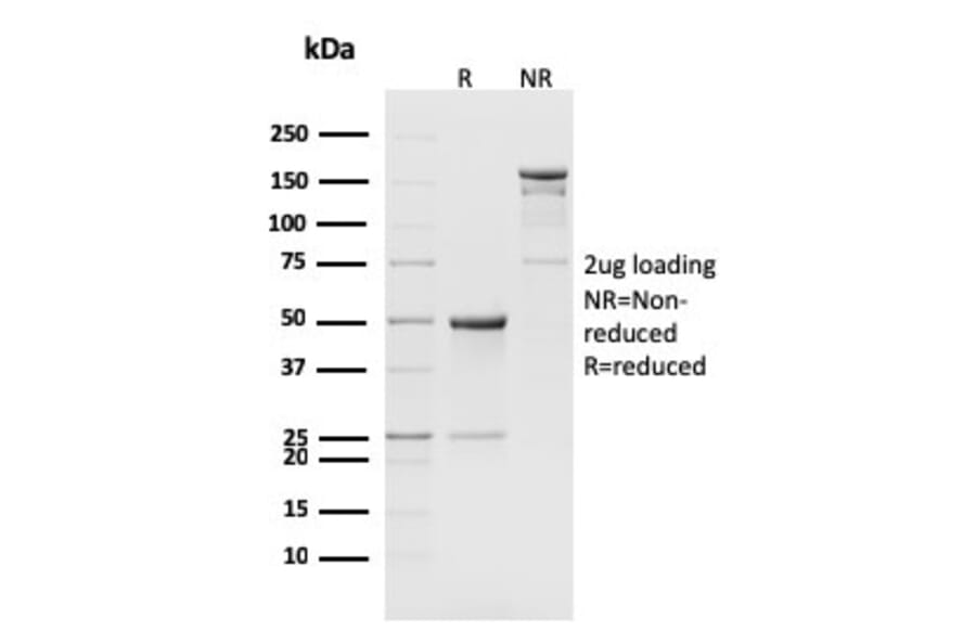 SDS-PAGE - Anti-CD8B Antibody [H35-17.2] (A251033) - Antibodies.com