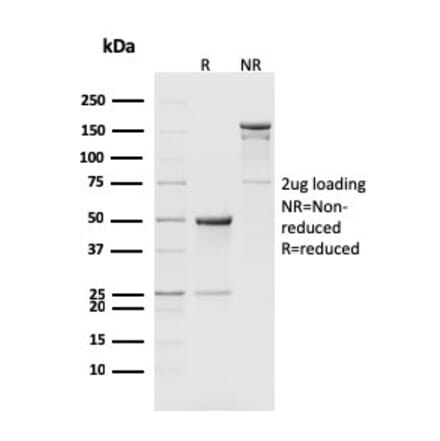 SDS-PAGE - Anti-CD8B Antibody [H35-17.2] (A251033) - Antibodies.com