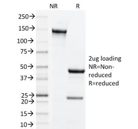 SDS-PAGE - Anti-CD134 Antibody [OX-86] (A251034) - Antibodies.com