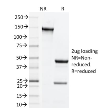 SDS-PAGE - Anti-CD134 Antibody [OX-86] (A251034) - Antibodies.com