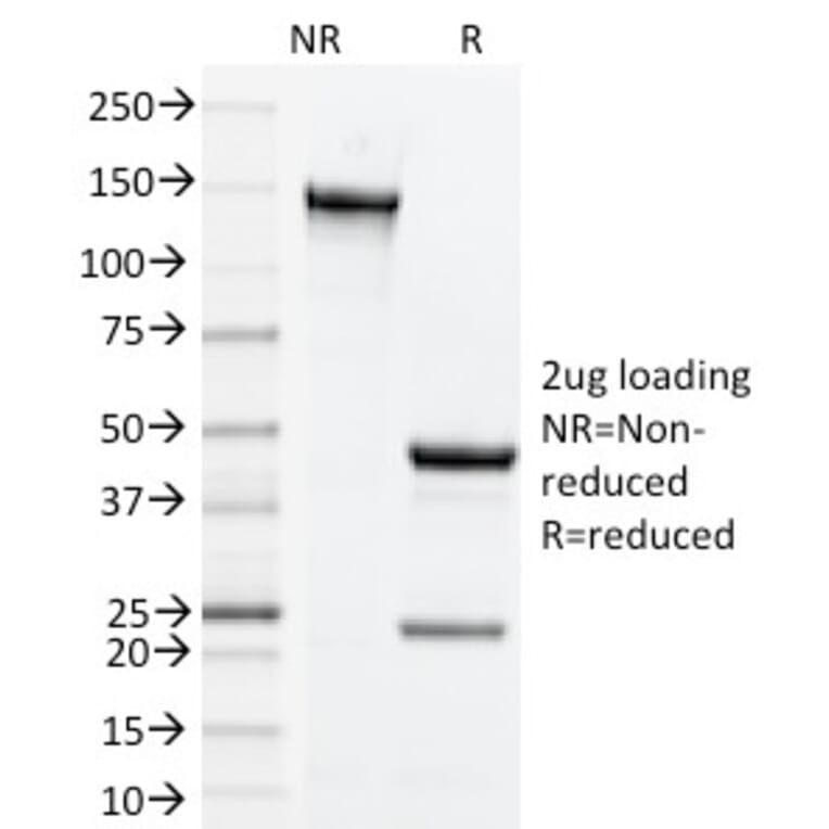 SDS-PAGE - Anti-CD134 Antibody [OX-86] (A251034) - Antibodies.com