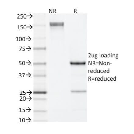 SDS-PAGE - Anti-IL-4 Antibody [11B11] (A251035) - Antibodies.com