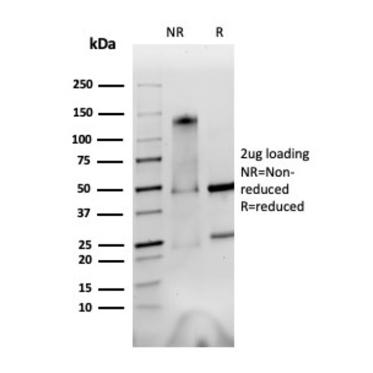 SDS-PAGE - Anti-Integrin alpha V + beta 6 Antibody [AvB6 53a.2] (A251037) - Antibodies.com