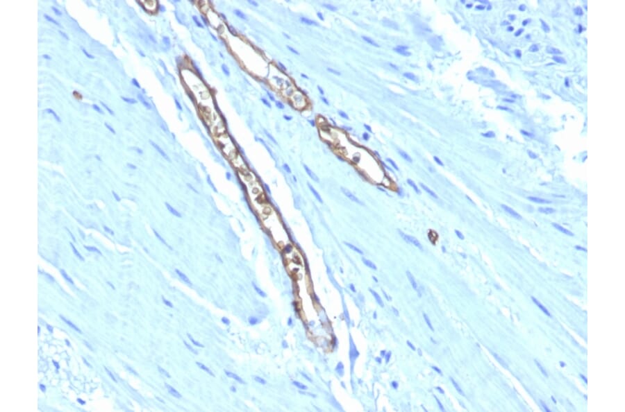 Immunohistochemistry - Anti-Blood Group Antigen A Antibody [HE-193] (A251042) - Antibodies.com