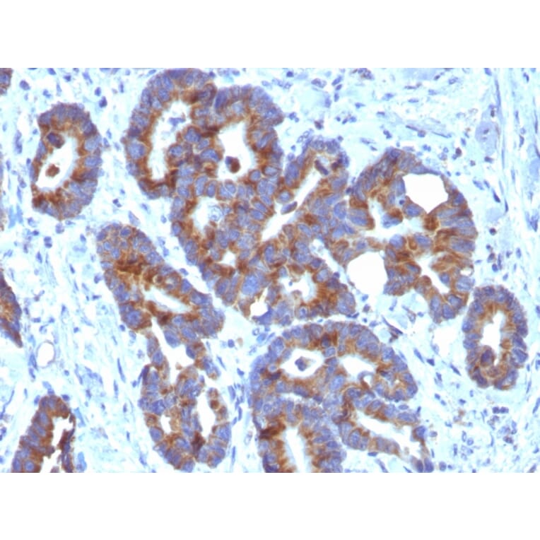 Immunohistochemistry - Anti-Blood Group Antigen A Antibody [HE-10] (A251044) - Antibodies.com