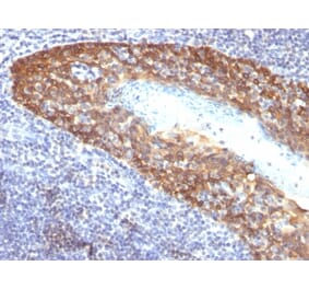 Immunohistochemistry - Anti-Cytokeratin 14 Antibody [KRT14/532] (A251049) - Antibodies.com