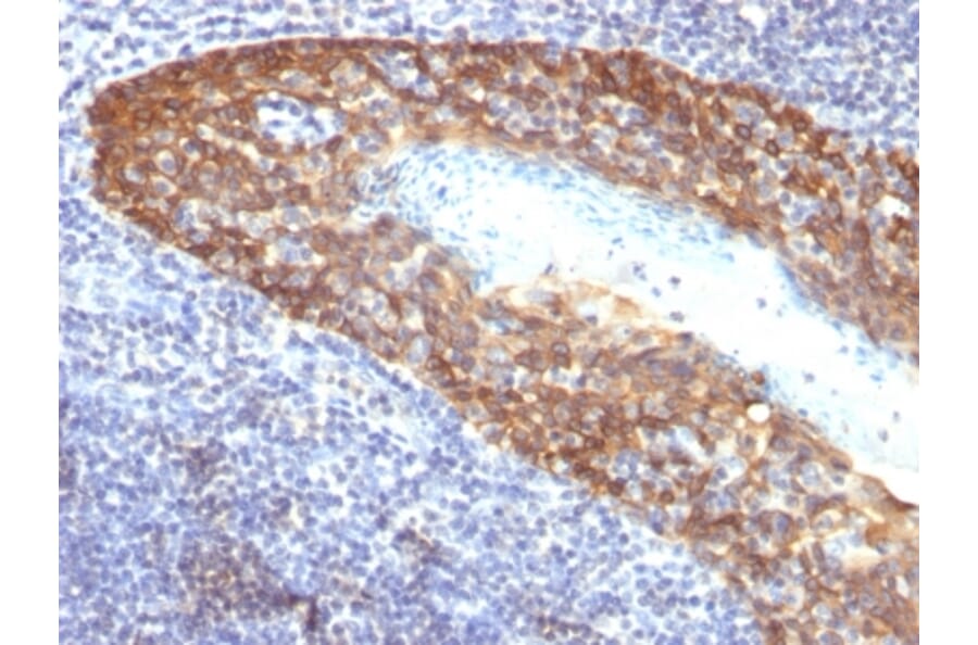 Immunohistochemistry - Anti-Cytokeratin 14 Antibody [KRT14/532] (A251049) - Antibodies.com
