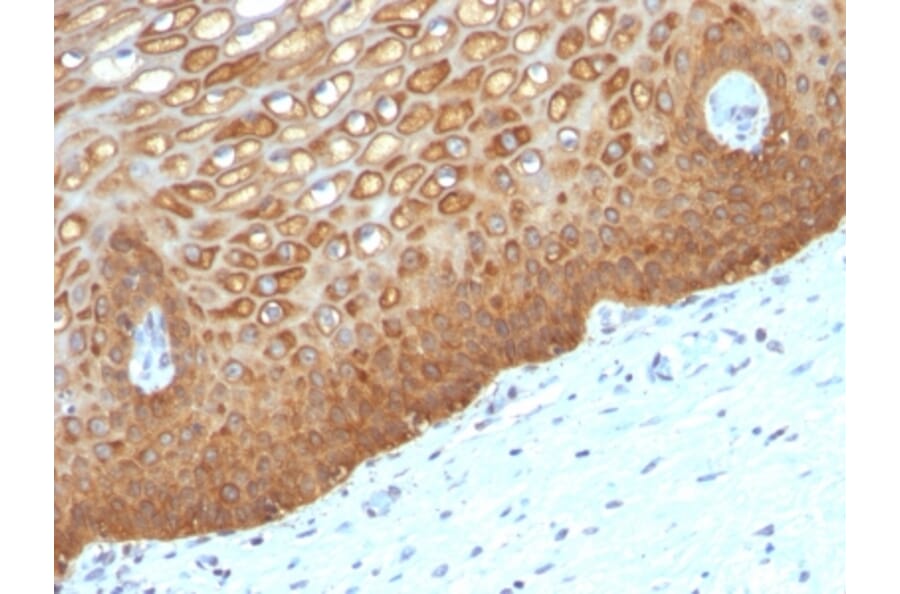 Immunohistochemistry - Anti-Cytokeratin 14 Antibody [KRT14/532] (A251046) - Antibodies.com