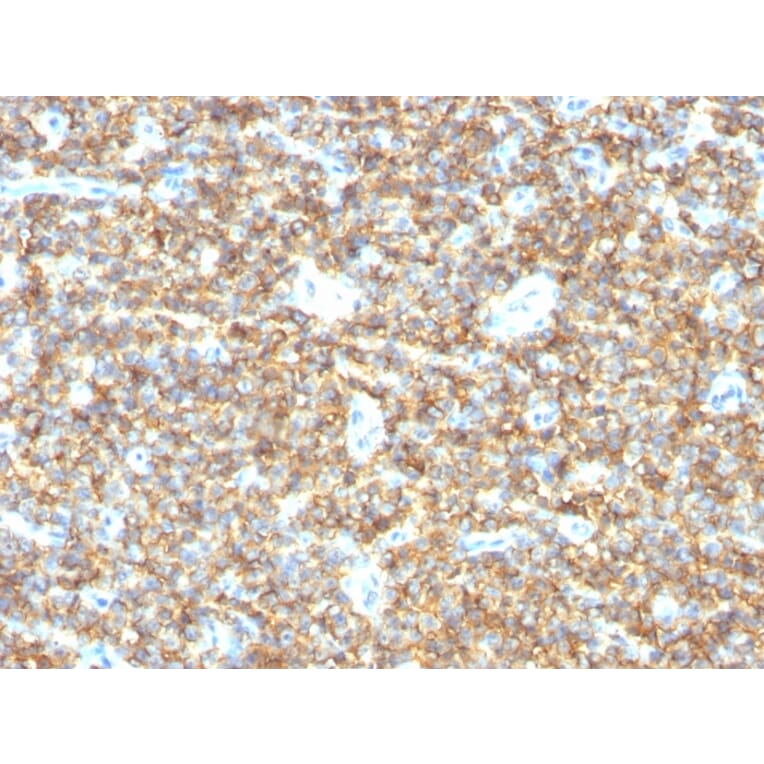 Immunohistochemistry - Anti-CD99 Antibody [HO36-1.1] (A251049) - Antibodies.com