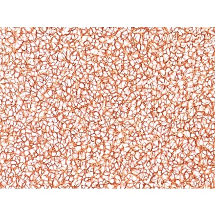 Immunohistochemistry - Anti-CD99 Antibody [SPM586] (A251050) - Antibodies.com