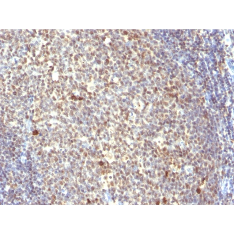 Immunohistochemistry - Anti-NuMA Antibody [SPM300] (A251052) - Antibodies.com