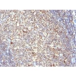 Immunohistochemistry - Anti-NuMA Antibody [SPM300] (A251052) - Antibodies.com