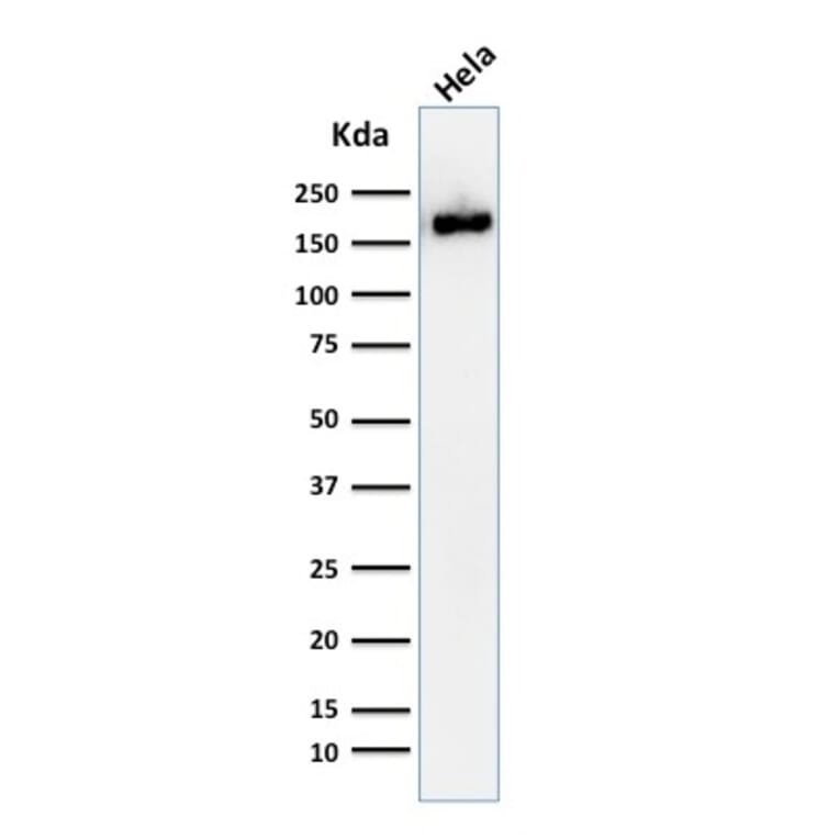 Western Blot - Anti-Podocalyxin Antibody [2A4] (A251055) - Antibodies.com