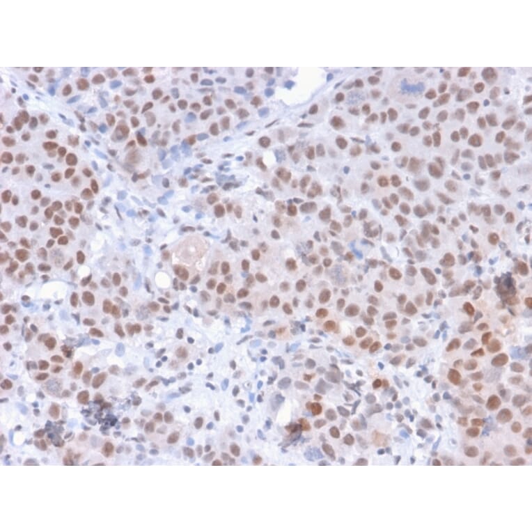 Immunohistochemistry - Anti-RNA Polymerase II CTD repeat YSPTSPS (phospho Ser5) Antibody [CTD 8A7] (A251055) - Antibodies.com