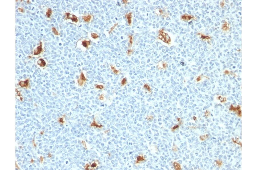 Immunohistochemistry - Anti-Calprotectin Antibody [S100A9/1011] (A253109) - Antibodies.com