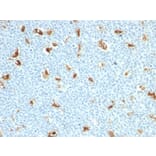 Immunohistochemistry - Anti-Calprotectin Antibody [S100A9/1011] (A253109) - Antibodies.com