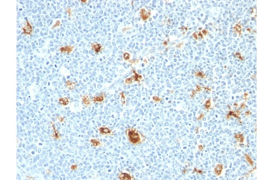 Immunohistochemistry - Anti-Calprotectin Antibody [CAGB/426] (A251057) - Antibodies.com