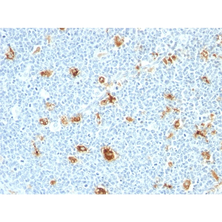 Immunohistochemistry - Anti-Calprotectin Antibody [CAGB/426] (A251057) - Antibodies.com