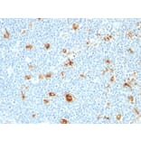 Immunohistochemistry - Anti-Calprotectin Antibody [CAGB/426] (A251057) - Antibodies.com