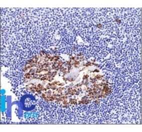 Immunohistochemistry - Anti-CDw75 Antibody [LN-1] (A251061) - Antibodies.com