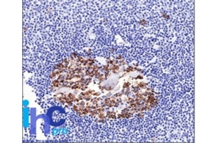 Immunohistochemistry - Anti-CDw75 Antibody [LN-1] (A251061) - Antibodies.com