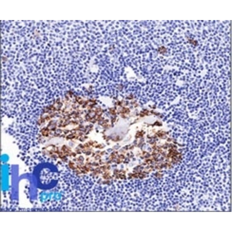 Immunohistochemistry - Anti-CDw75 Antibody [LN-1] (A251061) - Antibodies.com