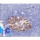 Immunohistochemistry - Anti-CDw75 Antibody [LN-1] (A251061) - Antibodies.com