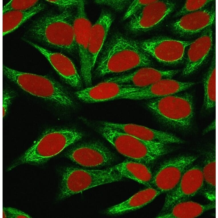 Immunofluorescence - Anti-CDw75 Antibody [LN-1] (A251061) - Antibodies.com