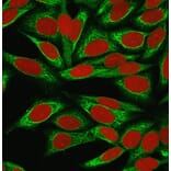 Immunofluorescence - Anti-CDw75 Antibody [LN-1] (A251061) - Antibodies.com