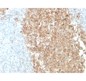 Immunohistochemistry - Anti-CDw75 Antibody [ZB55] (A251062) - Antibodies.com