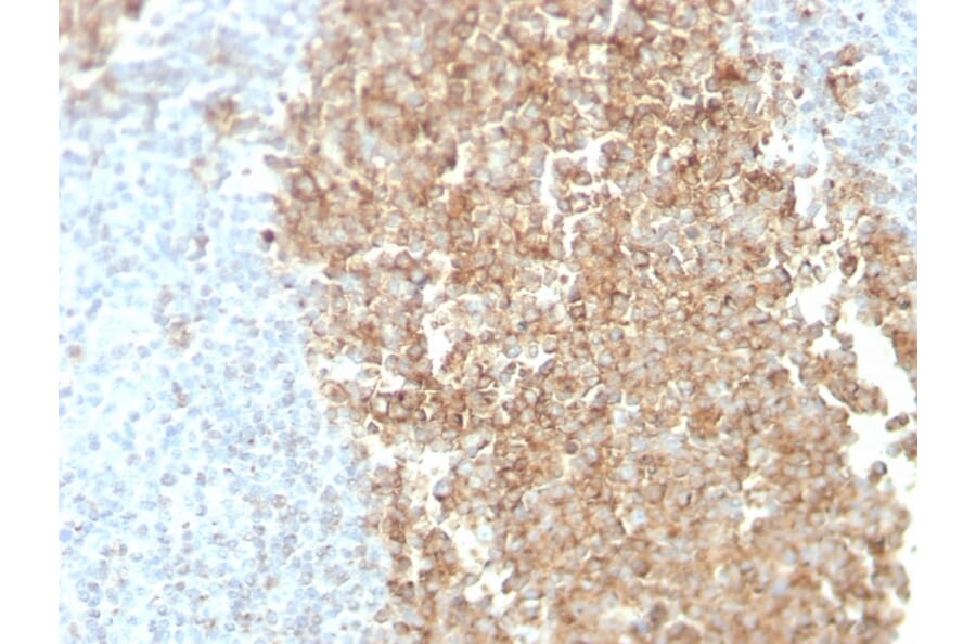 Immunohistochemistry - Anti-CDw75 Antibody [ZB55] (A251062) - Antibodies.com