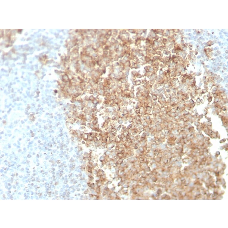 Immunohistochemistry - Anti-CDw75 Antibody [ZB55] (A251062) - Antibodies.com