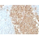 Immunohistochemistry - Anti-CDw75 Antibody [ZB55] (A251062) - Antibodies.com