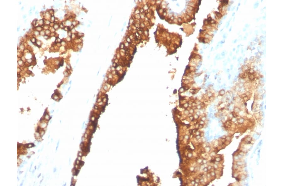 Immunohistochemistry - Anti-CDw75 Antibody [ZB55] (A251061) - Antibodies.com