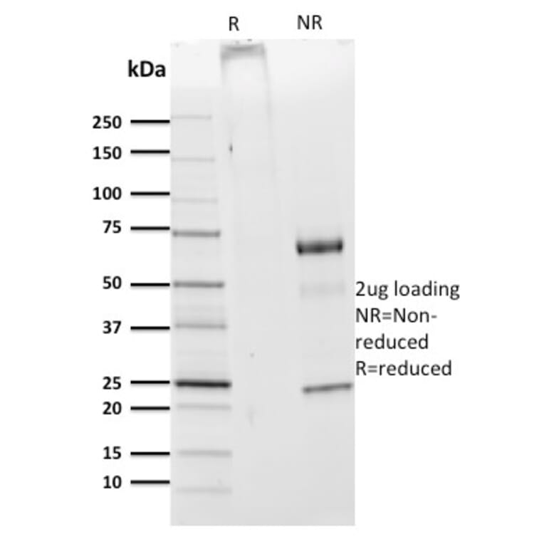 SDS-PAGE - Anti-CDw75 Antibody [ZB55] (A251062) - Antibodies.com