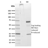 SDS-PAGE - Anti-CDw75 Antibody [ZB55] (A251062) - Antibodies.com