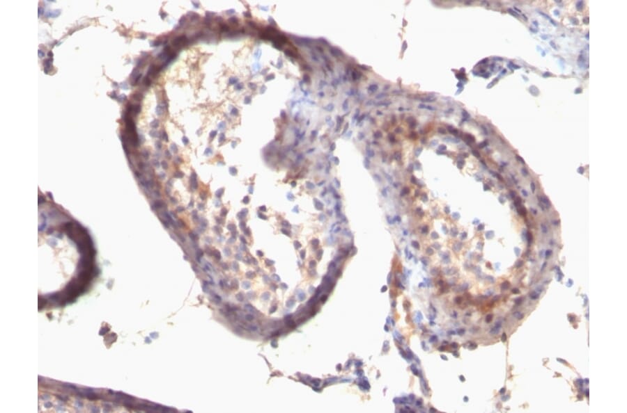 Immunohistochemistry - Anti-TGF alpha Antibody [SPM542] (A251067) - Antibodies.com