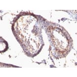 Immunohistochemistry - Anti-TGF alpha Antibody [SPM542] (A251067) - Antibodies.com