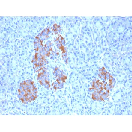 Immunohistochemistry - Anti-TNF alpha Antibody [TNFA/1172] (A251069) - Antibodies.com