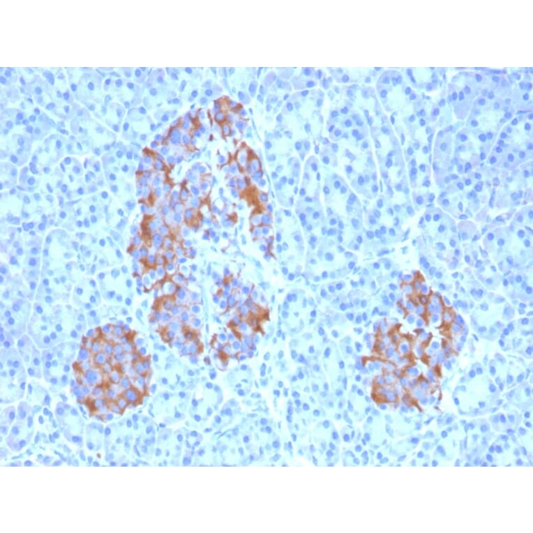 Immunohistochemistry - Anti-TNF alpha Antibody [TNFA/1172] (A251069) - Antibodies.com