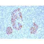 Immunohistochemistry - Anti-TNF alpha Antibody [TNFA/1172] (A251069) - Antibodies.com