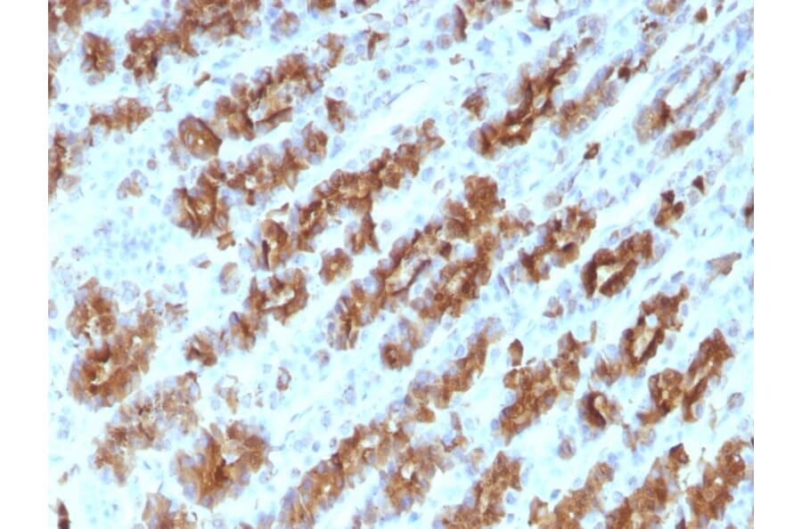 Immunohistochemistry - Anti-TNF alpha Antibody [TNFA/1172] (A251069) - Antibodies.com