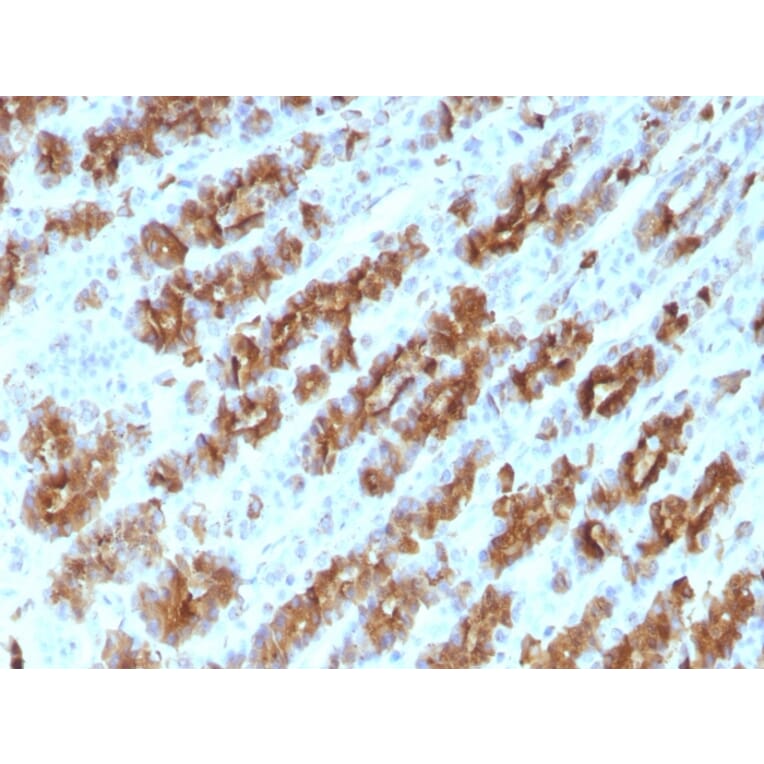 Immunohistochemistry - Anti-TNF alpha Antibody [TNFA/1172] (A251069) - Antibodies.com